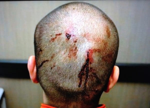 George-Zimmermans-head-injuries-on-the-night-that-he-shot-and-killed-Trayvon-Martin-courtesy-Fox-News-600x433.jpg
