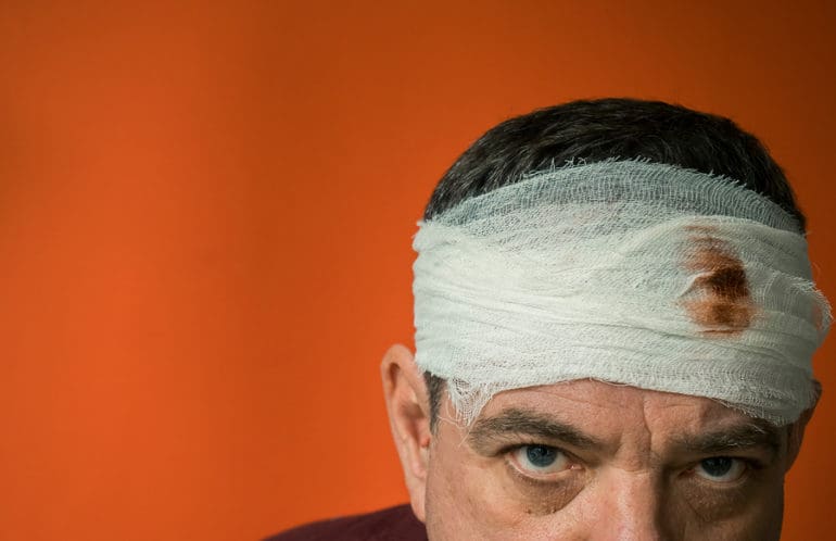 Head injury. Mature man with bandaged forehead